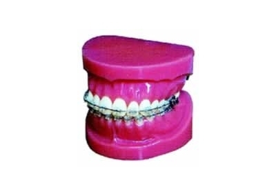 牙齿固定矫正模型(正常)