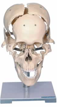 颅骨骨性分离模型