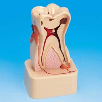 牙齿病变综合病理分解模型