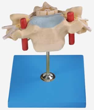 颈椎附脊髓和脊神经放大模型