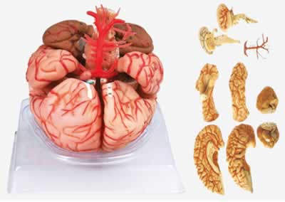 脑动脉模型