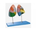 SYL/13010-1 肺段模型