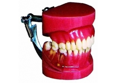 牙周病演示模型