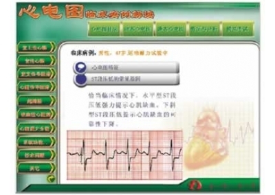 SYL/XDR 新版心电图教学软件,心电图临床实例解读