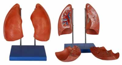 肺解剖模型