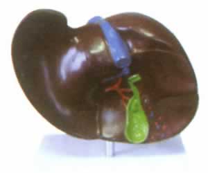 肝胆结石模型