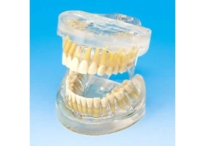 透明成人牙模型
