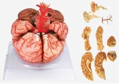 SYL/18220 脑动脉模型