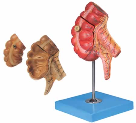 盲肠和阑尾模型