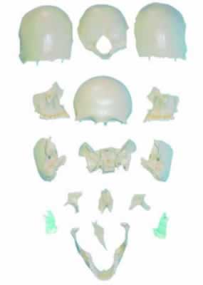 部分颅骨散骨模型
