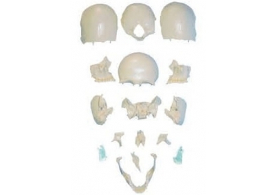 SYL/11117-2 分离头颅骨散骨模型