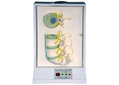 SYL/2036 腰骶椎、椎间盘和脊神经电动模型