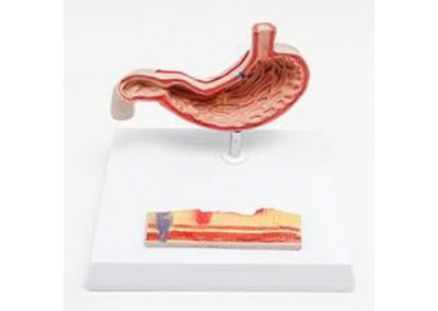 SYL/4049 病理胃模型