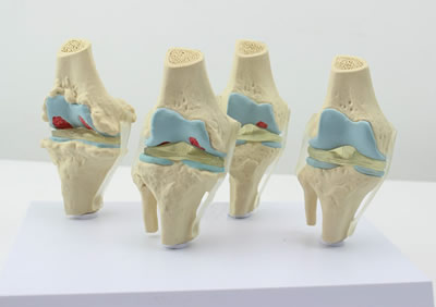 四阶段膝关节模型