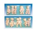 SYL/42014胎儿畸形模型