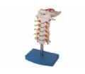 SYL/A133颈椎带颈动脉、后枕骨、椎间盘与神经模型