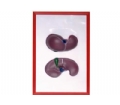 SYL/2079-17肝脏浮雕模型
