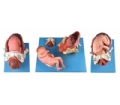 SYL/42007 足月胎儿分娩过程模型