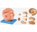SYL/18219 头部附脑和动脉模型