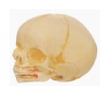 SYL/11115 婴儿头颅骨模型