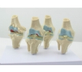 SYL/053 四阶段膝关节模型